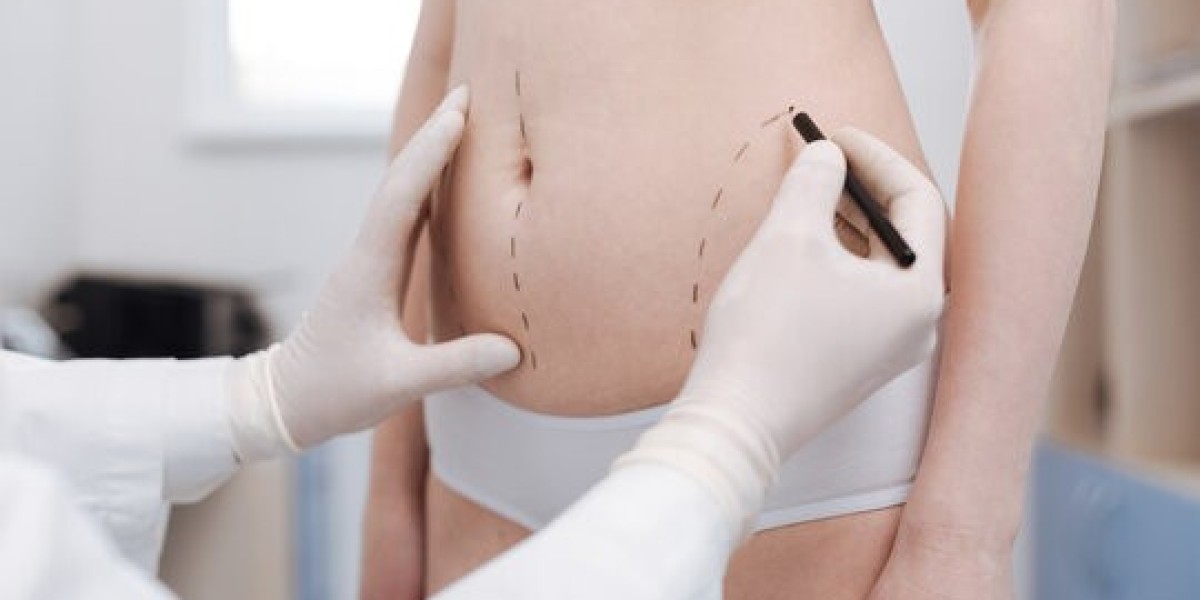Precision Sculpting Achieving the Six Pack with Hi Def Liposuction in KSA