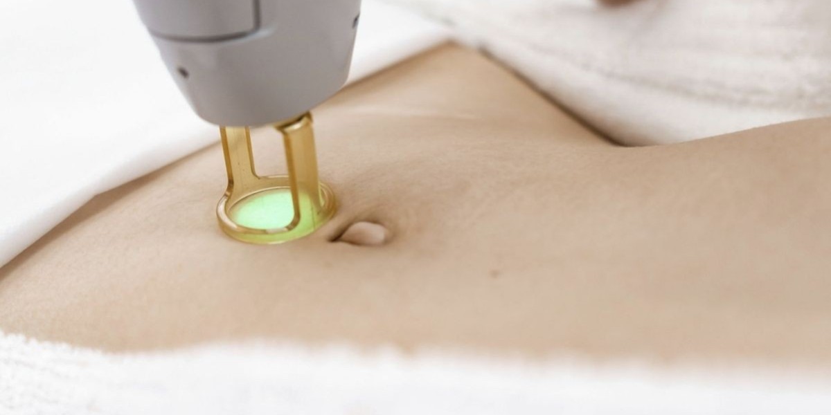 How Safe Is Laser Hair Removal in Dubai? What You Should Know