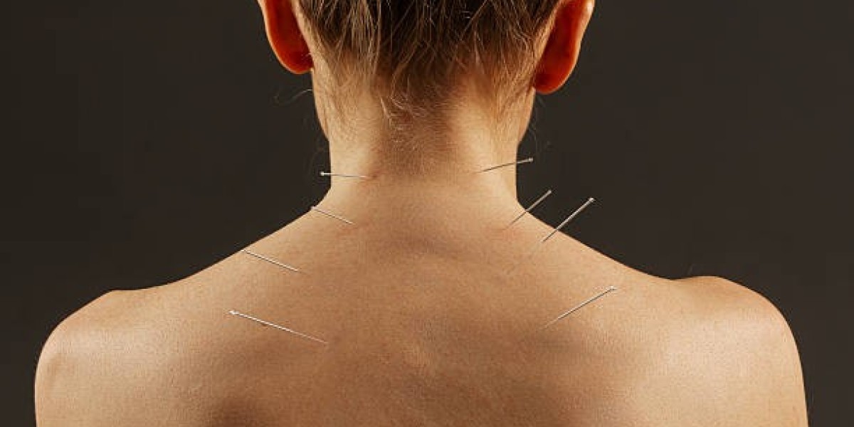 What Are the Different Types of Acupuncture Treatment Techniques?
