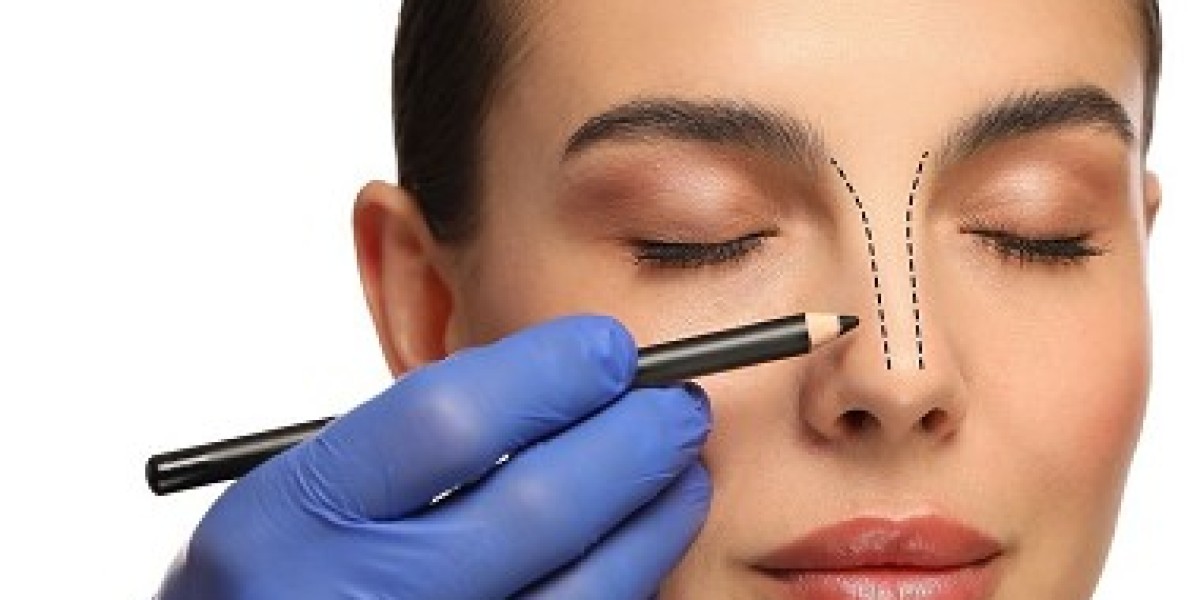 Rhinoplasty in Dubai: Benefits and Risks You Should Know Before Surgery