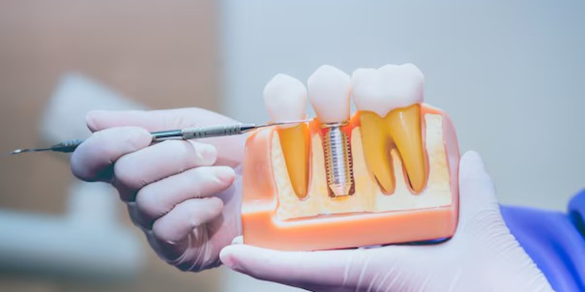 Restoring Smiles with Precision and Care
