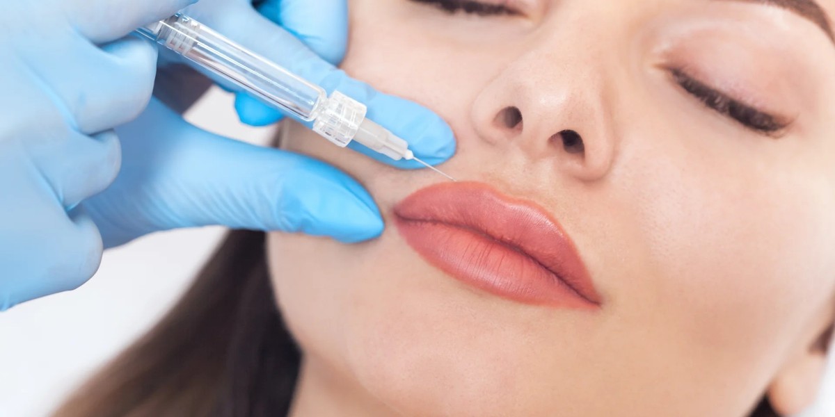 Lip Fillers Injections: Tips for a Comfortable Experience