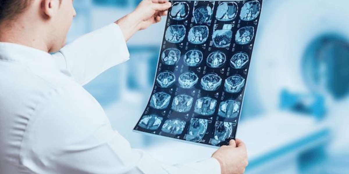 Decoding Your Radiology Report: What Do Those Terms Mean?