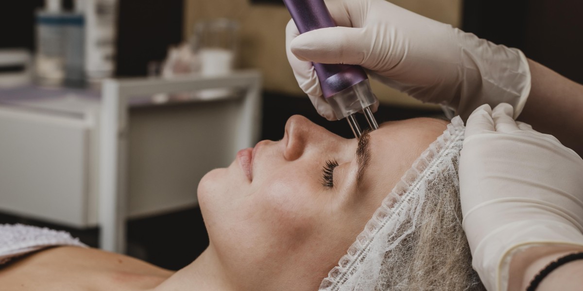 SkinPen Microneedling in Birmingham: Why Areje Aesthetics Is a Top Choice for Renewed, Glowing Skin