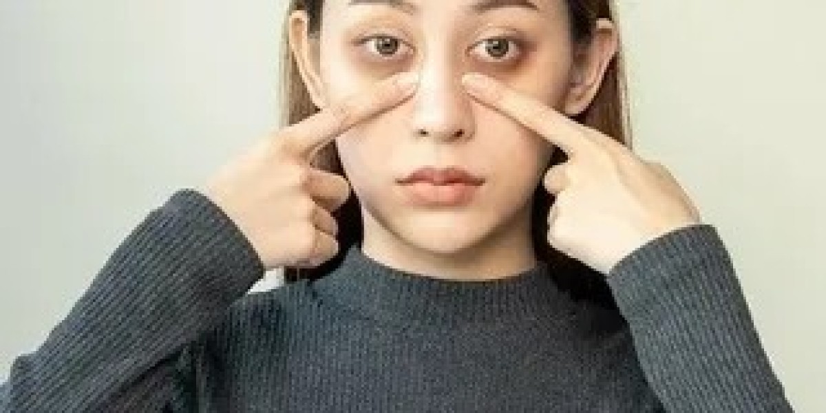 Quick Dark Circles Treatment in Islamabad