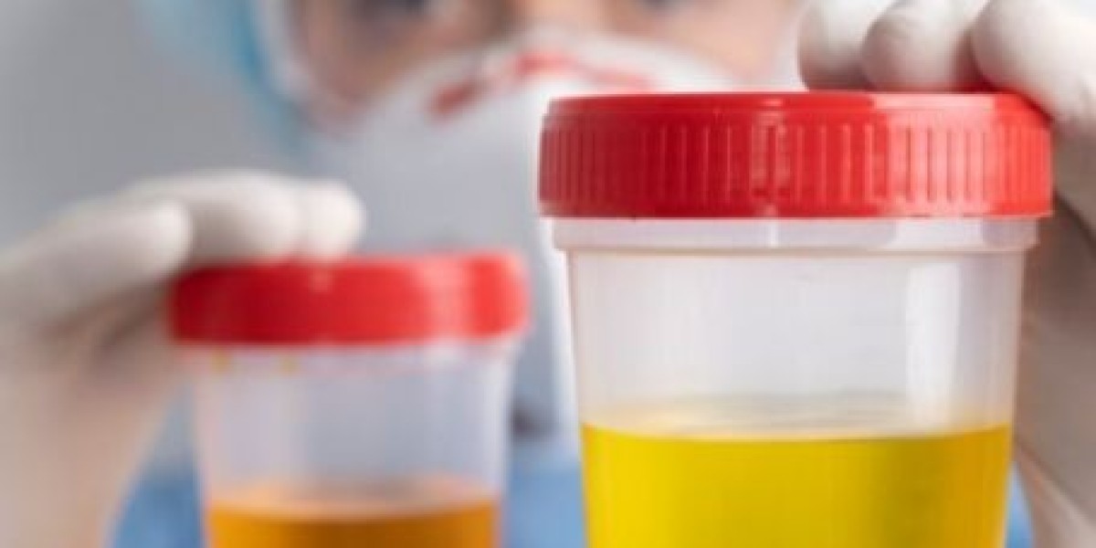 Understanding the 24-Hour Urine 5-HIAA Test: Purpose, Procedure, and What to Expect