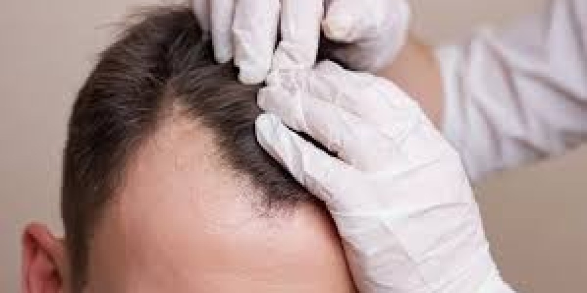 Stem Cell Hair Transplant Can It Repair Damaged Hair Follicles?