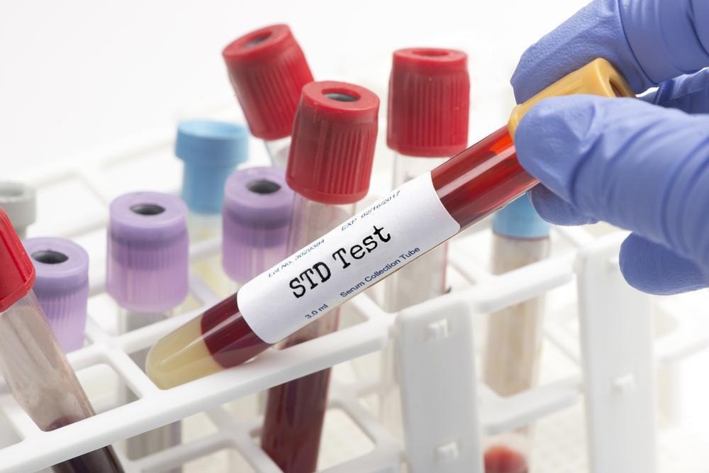 STD Test
