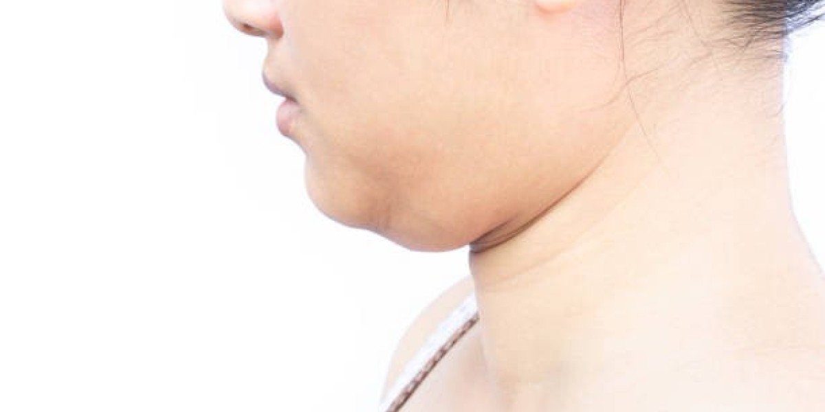 Will Double Chin Liposuction Help If I Have Loose Skin?