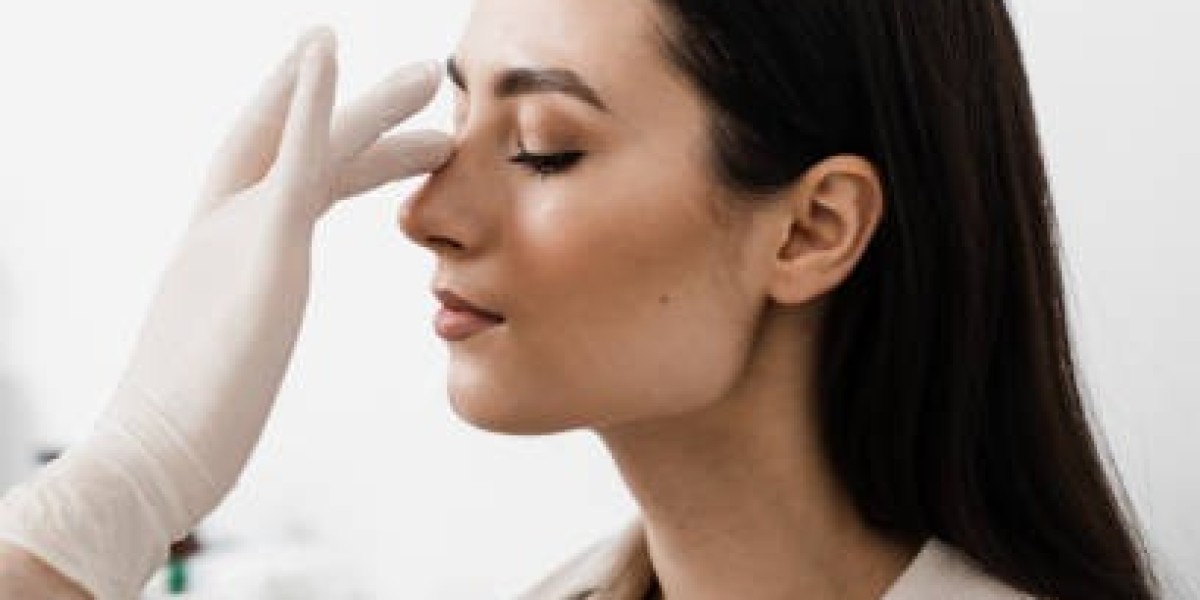 Common Questions About Rhinoplasty Answered