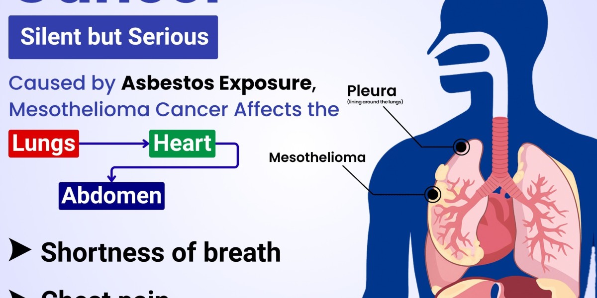 Dr. Ashvin Rangole – Global Cancer Hub | Leading Cancer Hospital in Indore