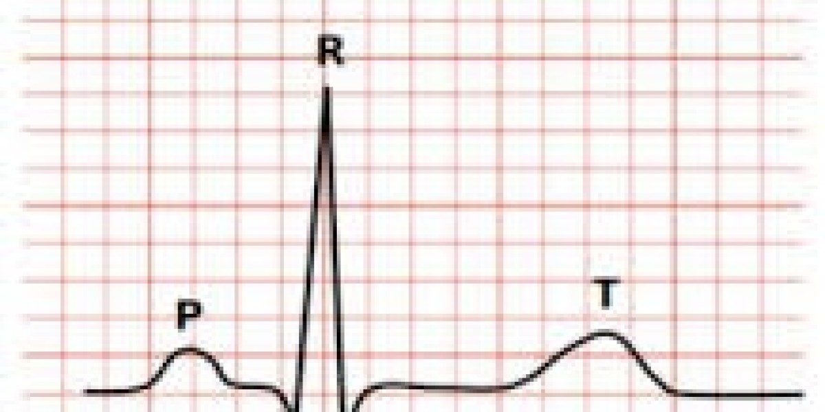 Electrocardiograph (ECG) Market report uncovers competitive landscape and innovation trends worldwide