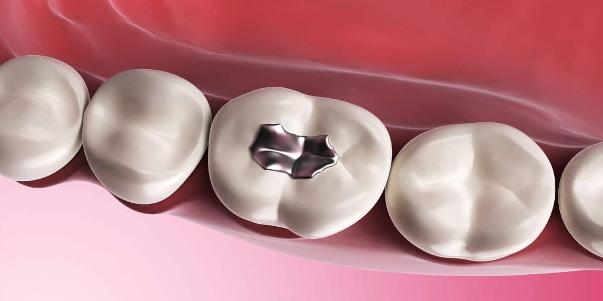 Eco-Friendly Tooth Filling Cost Options
