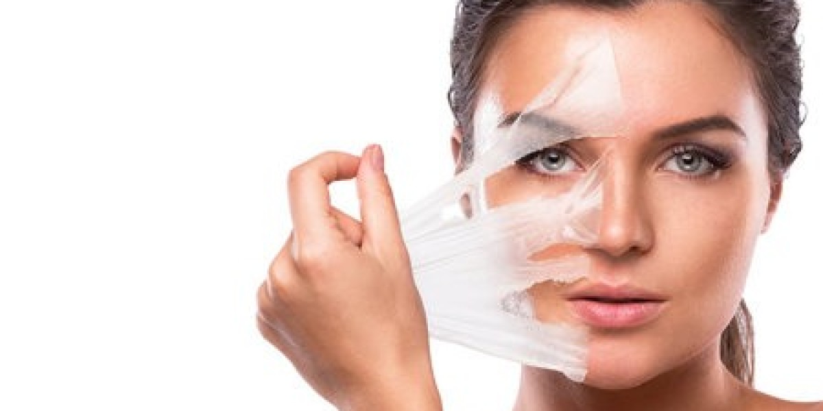 Best Practices for Chemical Skin Peel Recovery in Islamabad