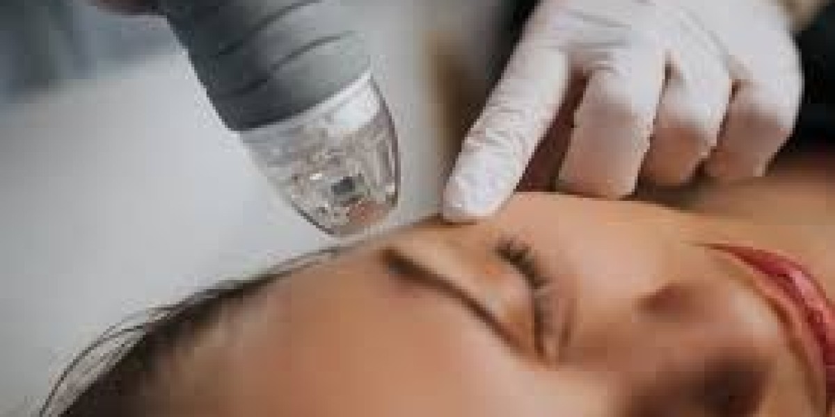 Can Dermapen Be Used Safely on Darker Skin Tones?
