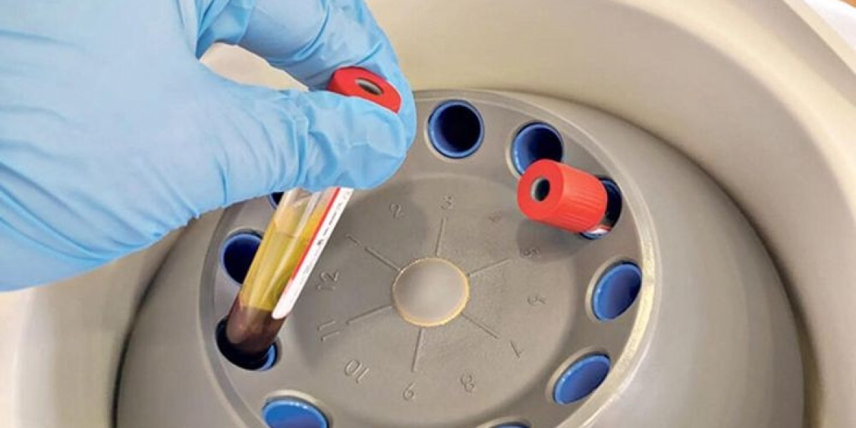 Why Blood Sugar and Cholesterol Tests Are Crucial for Everyone