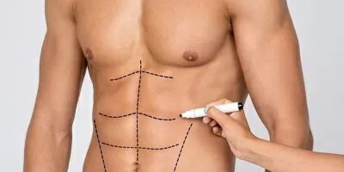 Liposuction in Dubai: Best Techniques (Laser, Vaser, Tumescent)