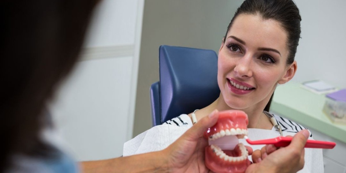 Full Mouth Dental Implants: A Permanent Solution for Tooth Loss