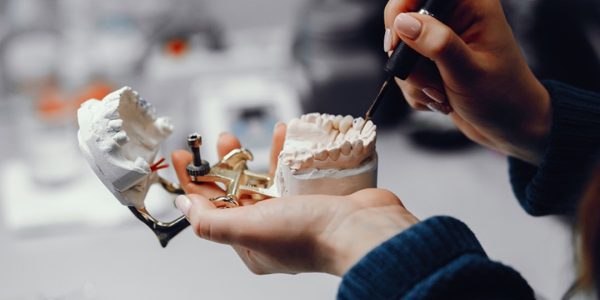 Exploring Major Types of Dental Implants: Which One Is Right for You?