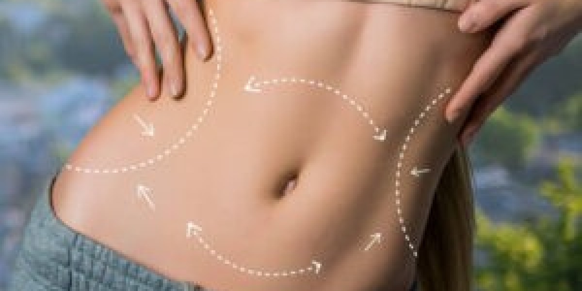 Liposuction in Dubai: Achieve a Sculpted Silhouette with Precision Treatment