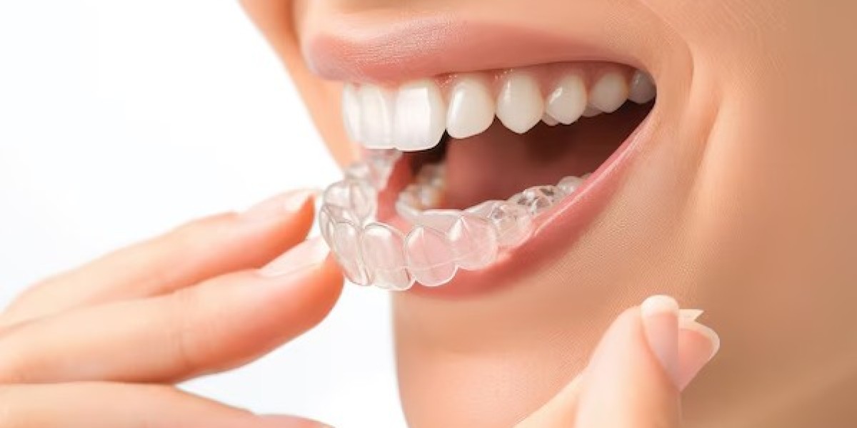 Understanding Braces: A Guide to Orthodontic Care the Journey to a Straighter Smile
