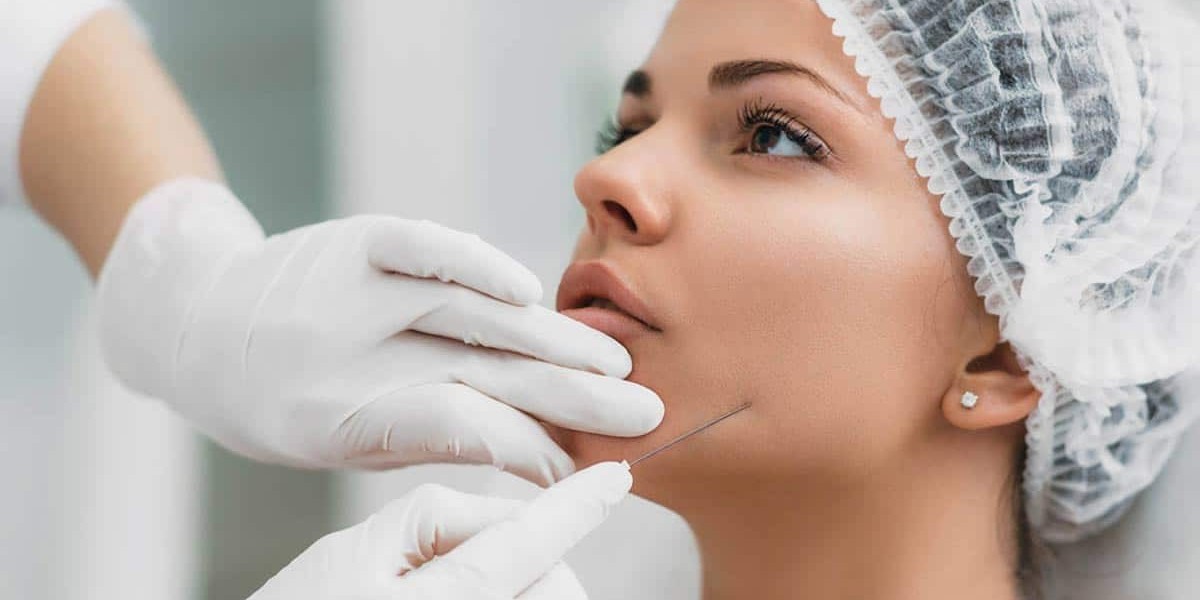 Key Benefits of Choosing Thread Lift in Islamabad