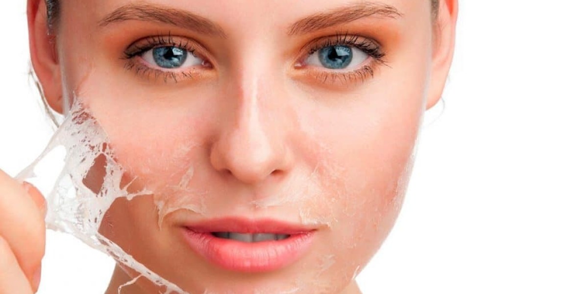 A Complete Guide to Pre and Post Chemical Peel Care
