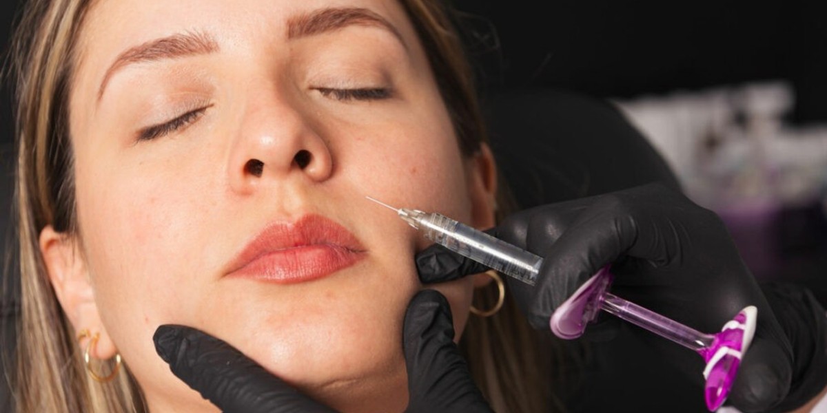 The Art of Aging Gracefully: Why Dubai’s Nasolabial Filler Craze Is Redefining Beauty