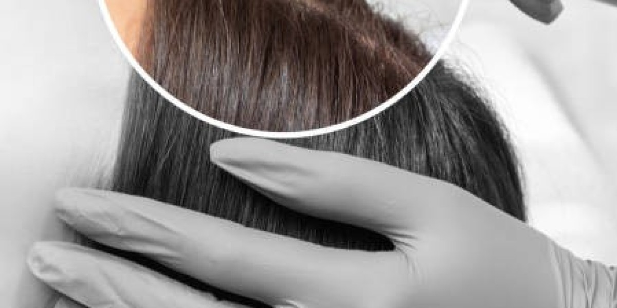 What to Expect During a PRP Hair Treatment Session in Riyadh
