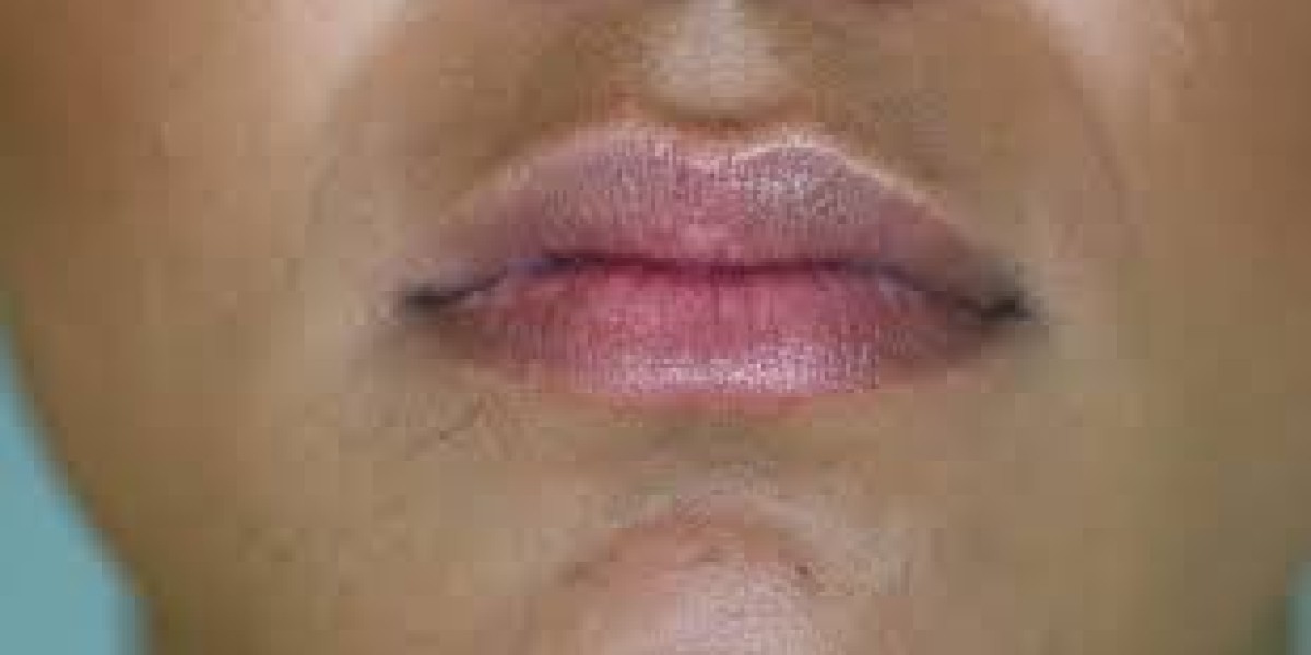 Can Smoker’s Lips Procedures Improve Overall Lip Health?