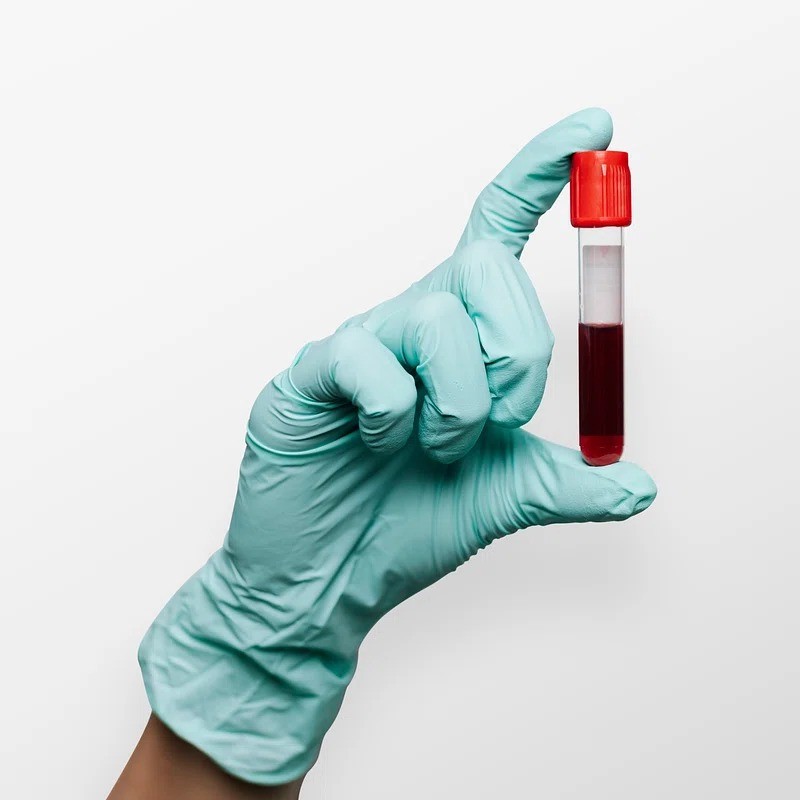 Blood Test at Home in Dubai