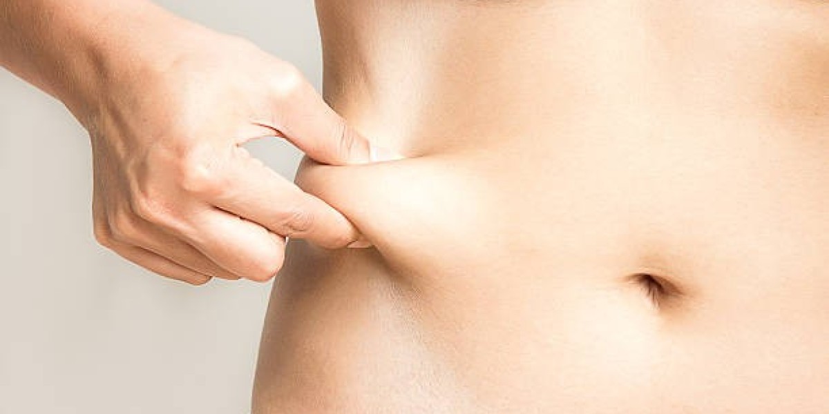 How Fat Reduction Techniques Have Evolved in Islamabad