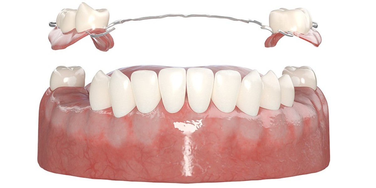 Finding the Best Teeth Whitening Near Me and Cosmetic Dentistry Near Me
