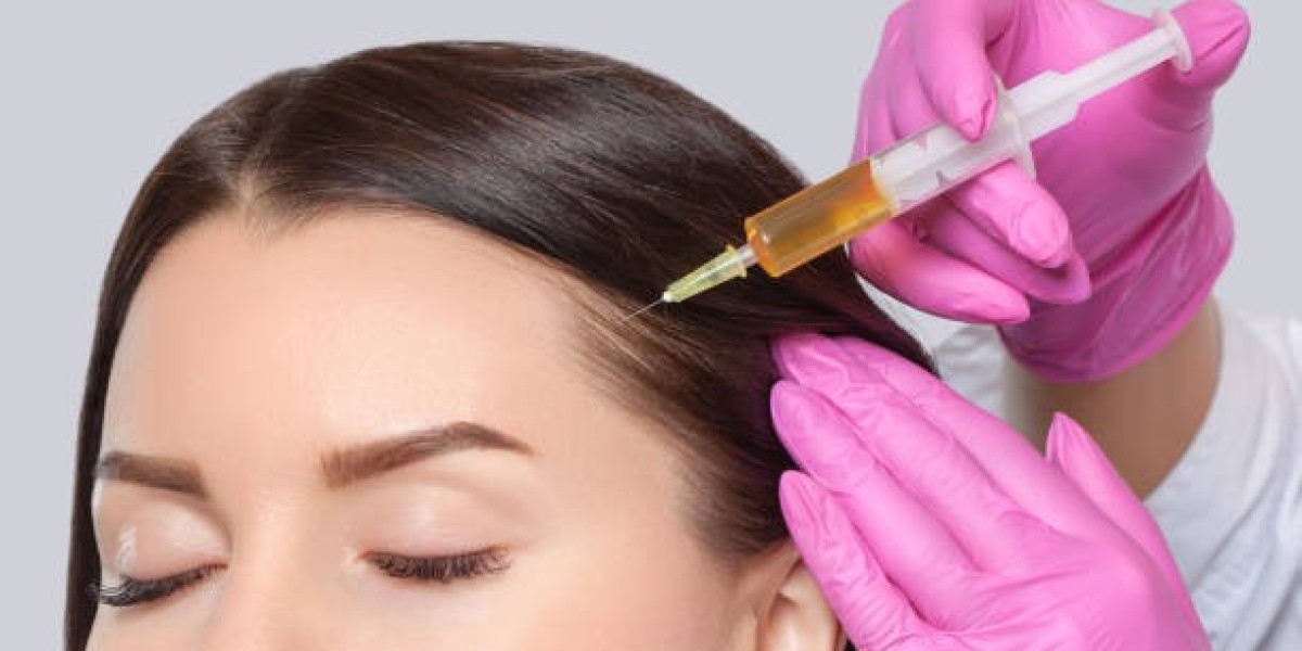 Why PRP Hair Treatment Is Considered a Natural Solution for Hair Loss