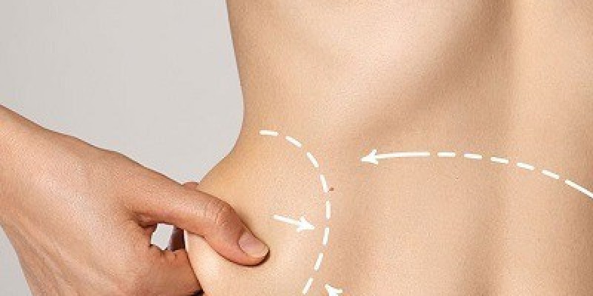 Liposuction in Dubai: Secrets to Achieving a Sculpted Waistline