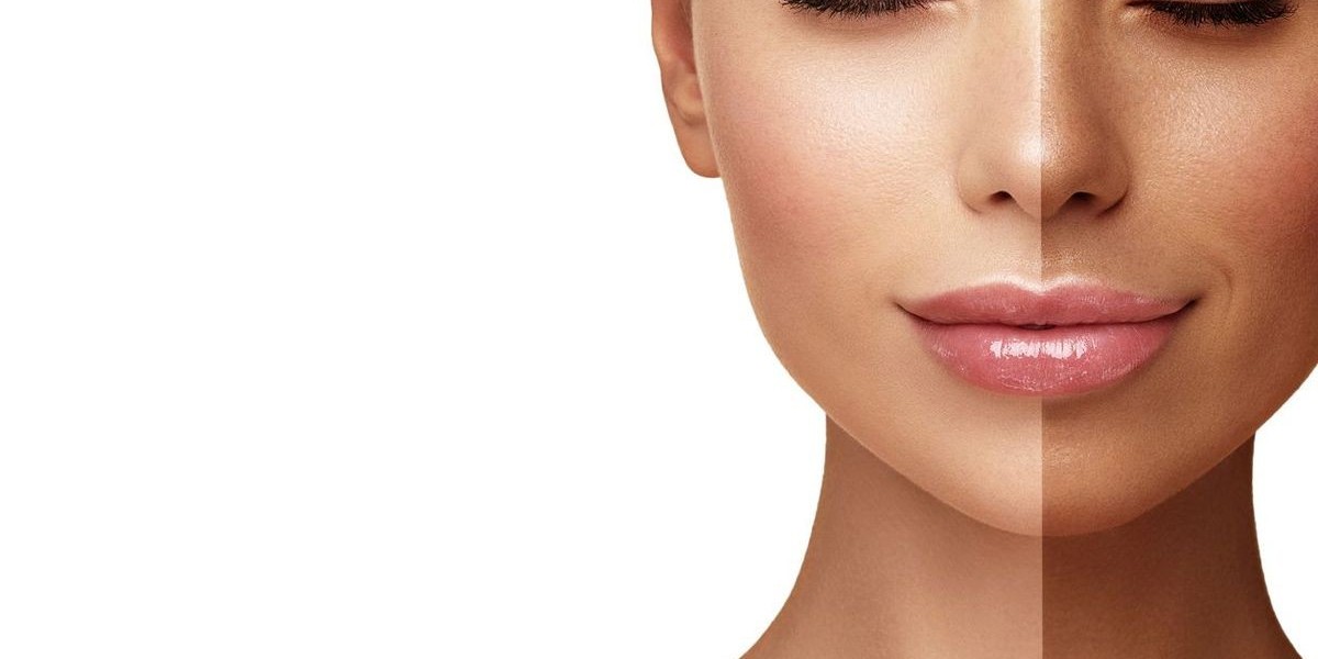 Comparing Popular Skin Whitening Techniques in Dubai: Which Is Best for You?