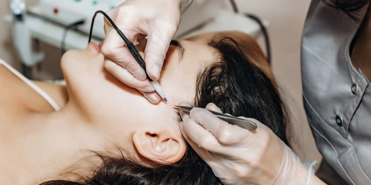 Safety Precautions for Electrolysis Hair Removal in Islamabad