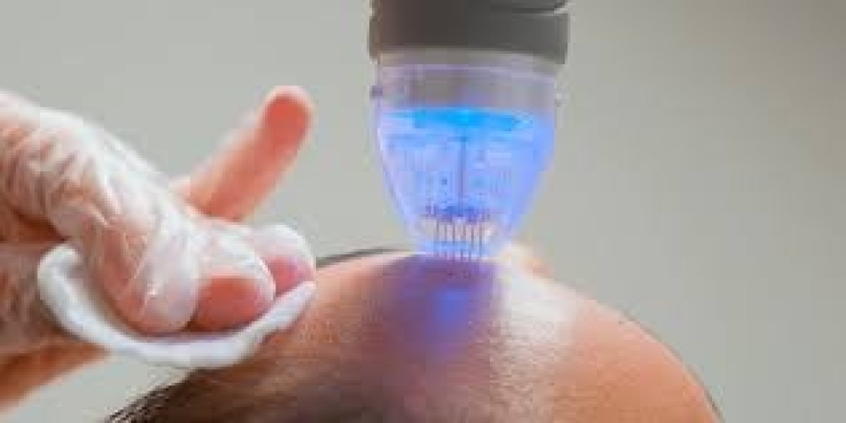 Microneedling Wilmington NC