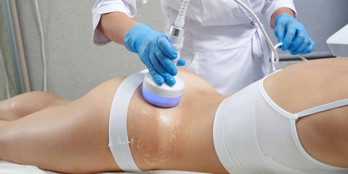 How Does the Laser Fat Reduction Procedure Work Step by Step?
