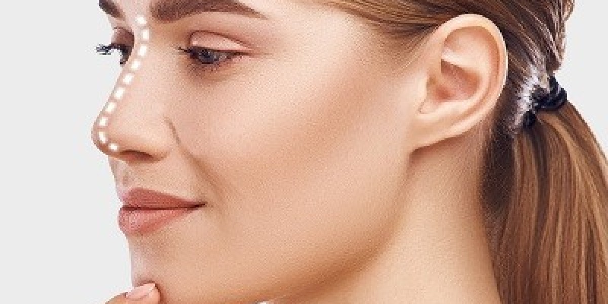 Transform Your Nose Beauty Instantly With Hiko Nose Thread Lift
