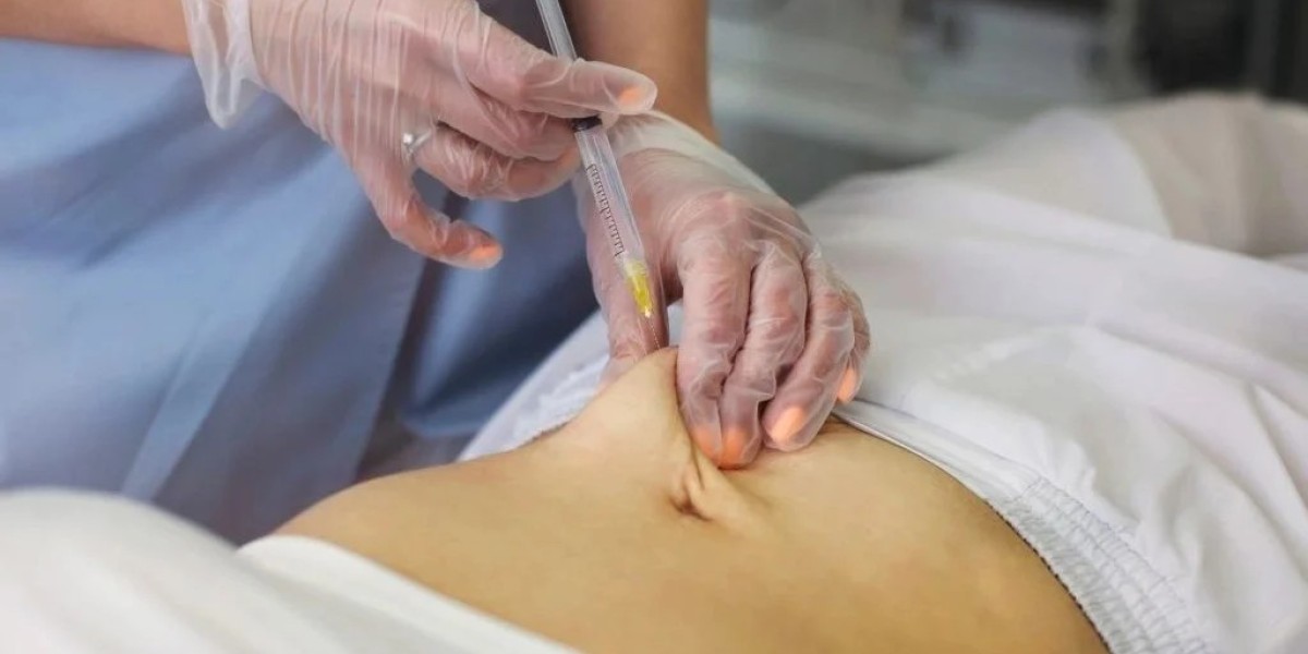 Can Mesotherapy Help Reduce Stubborn Belly Fat?