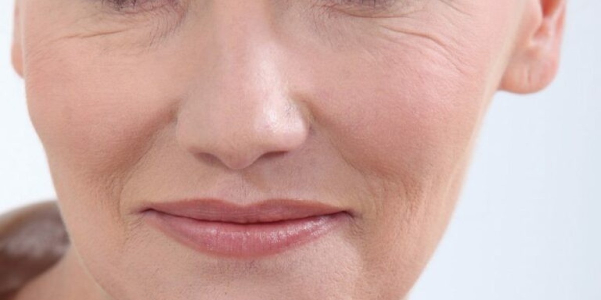 Can Wrinkle-Smoothing Procedures Reduce Deep Facial Lines?