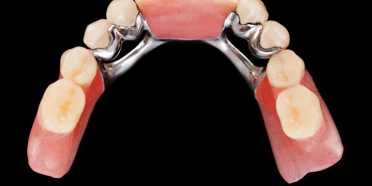 How Dentists Choose Between Crowns and Bridges