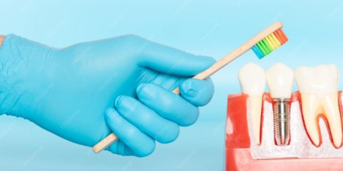 Are Dental Implants Safe and Long-Lasting? Key Facts You Should Know