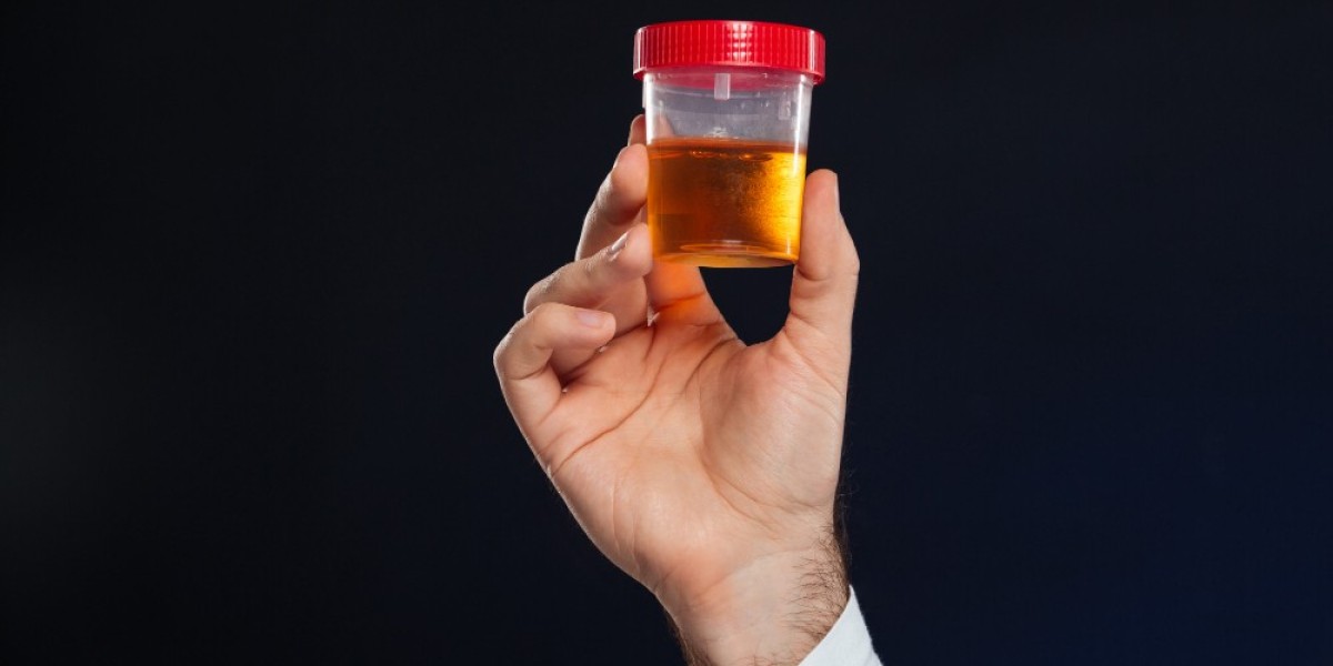 Understanding the 24-Hour Urine Ketosteroids Test: Purpose and Procedure