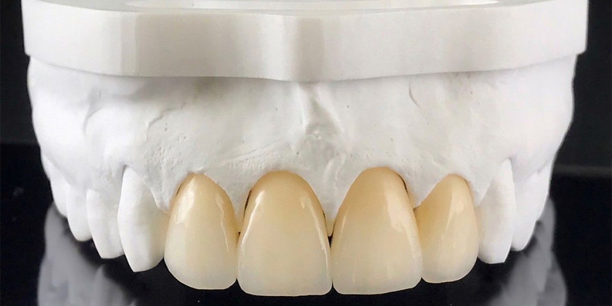 Zirconia Crown Dubai for Durable, Natural-Looking Restorations