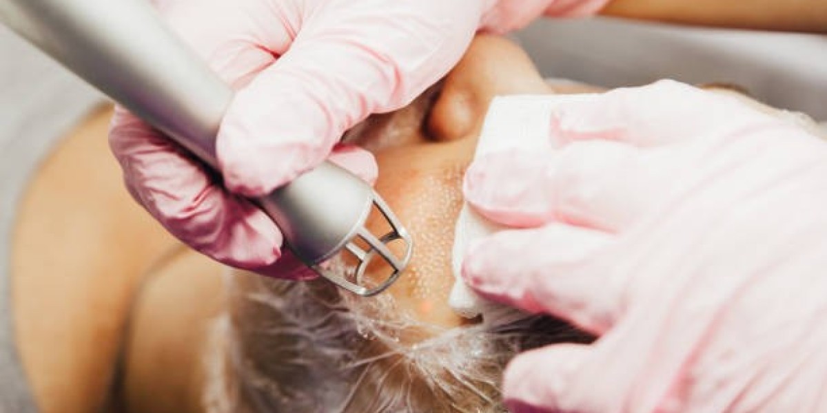 Fractional CO2 in Dubai for Post-Surgery Scar Removal