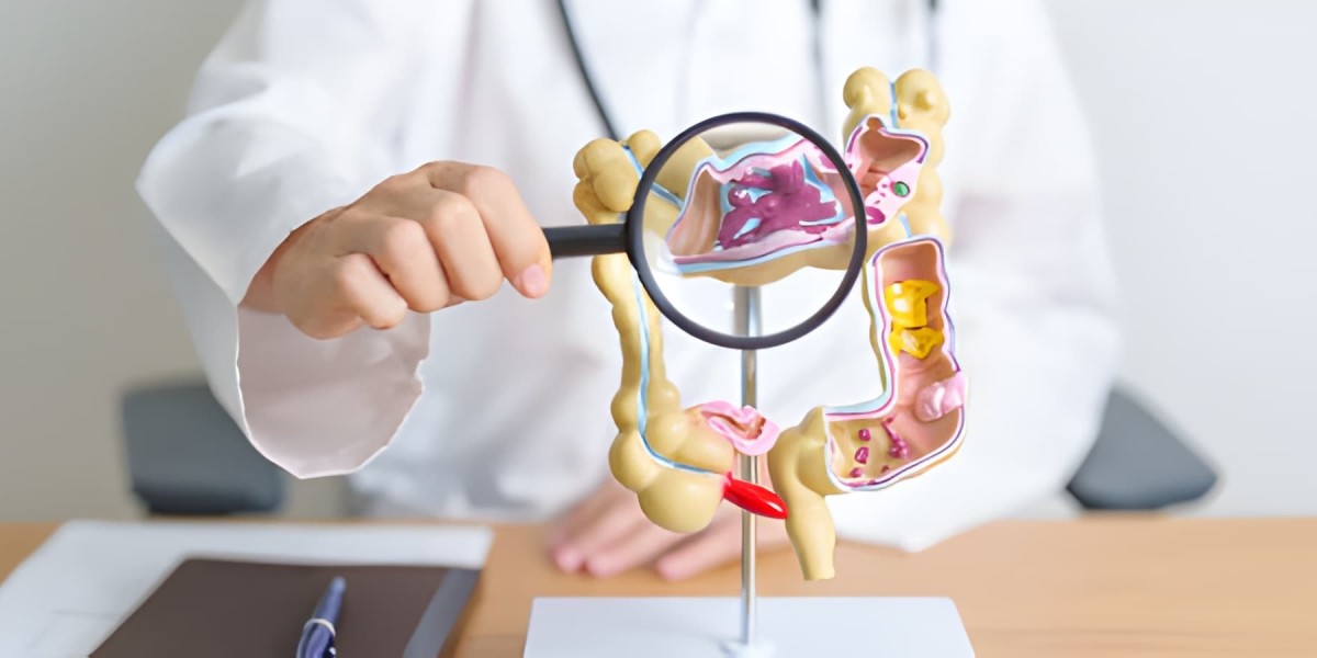 Evolving Perspectives on Crohn’s Disease: Causes, Symptoms & Future Advancements