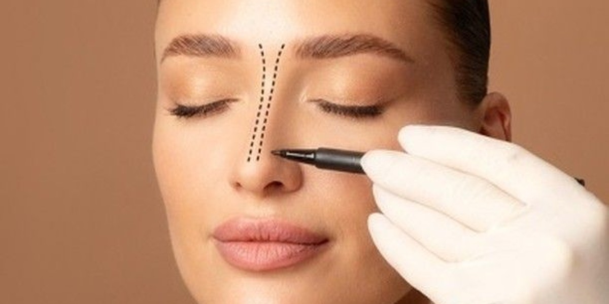 Revision Rhinoplasty in Dubai: Fixing Unsatisfactory Previous Results