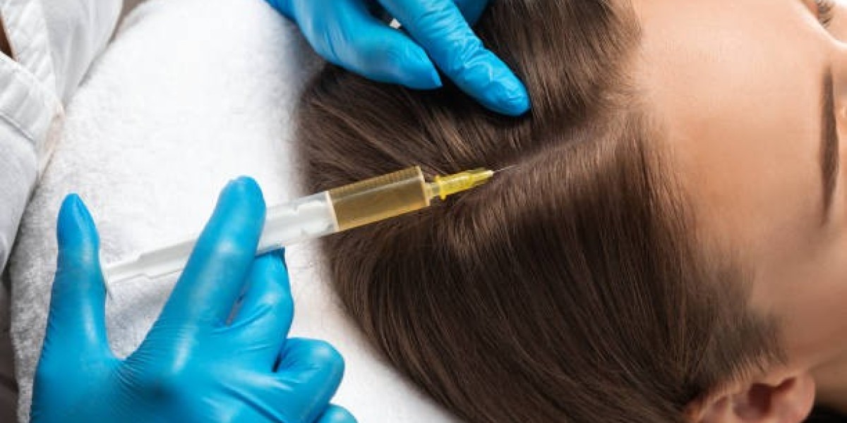 How to Choose PRP Hair Treatment in Dubai vs Hair Transplant